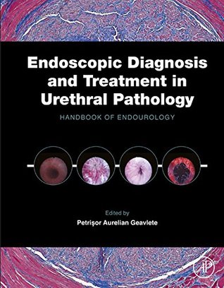 Full Download Endoscopic Diagnosis and Treatment in Urethral Pathology: Handbook of Endourology - Petrisor Aurelian Geavlete file in ePub