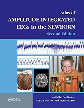Read Online An Atlas of Amplitude-Integrated EEGs in the Newborn (Encyclopedia of Visual Medicine Series) - Lena Hellström-Westas file in PDF