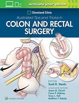 Download Cleveland Clinic Illustrated Tips and Tricks in Colon and Rectal Surgery - Cleveland Clinic Foundation file in ePub